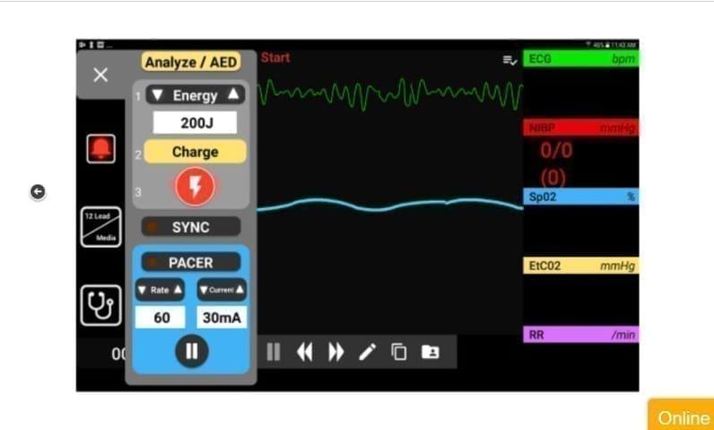 Life Like Simulation DiaMedical launches SimVS platform for lifelike simulation in different ...